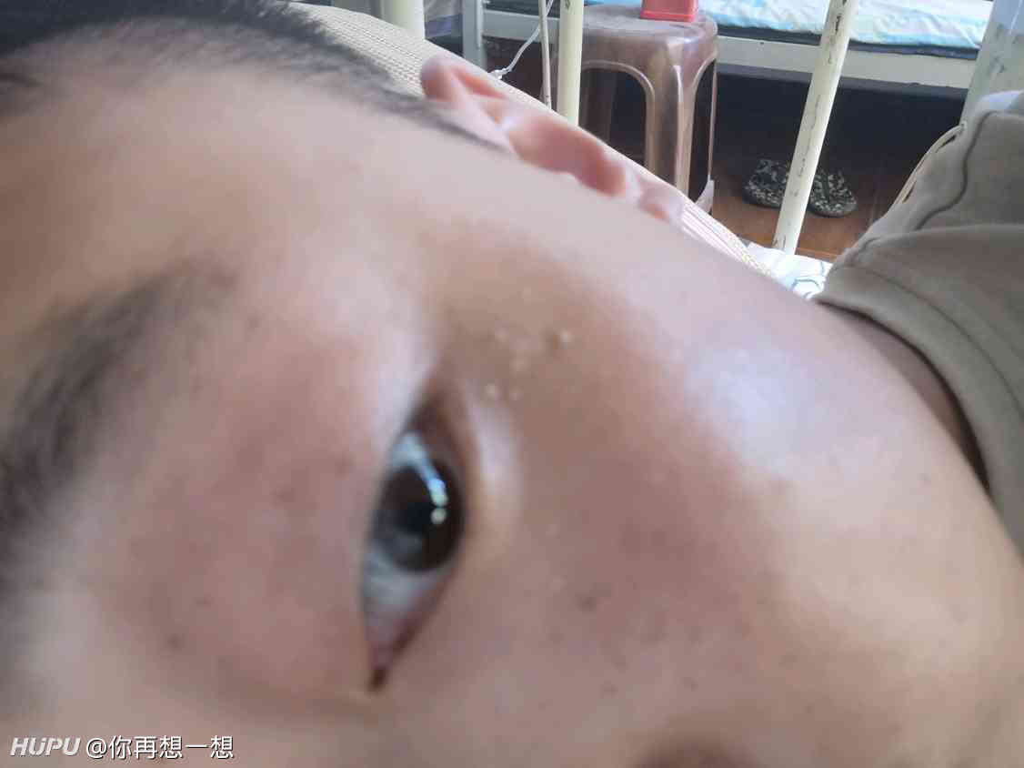 真话屋 二十年皮肤病大夫 不懂就问吧 19年8月日虎扑存档 看帖神器