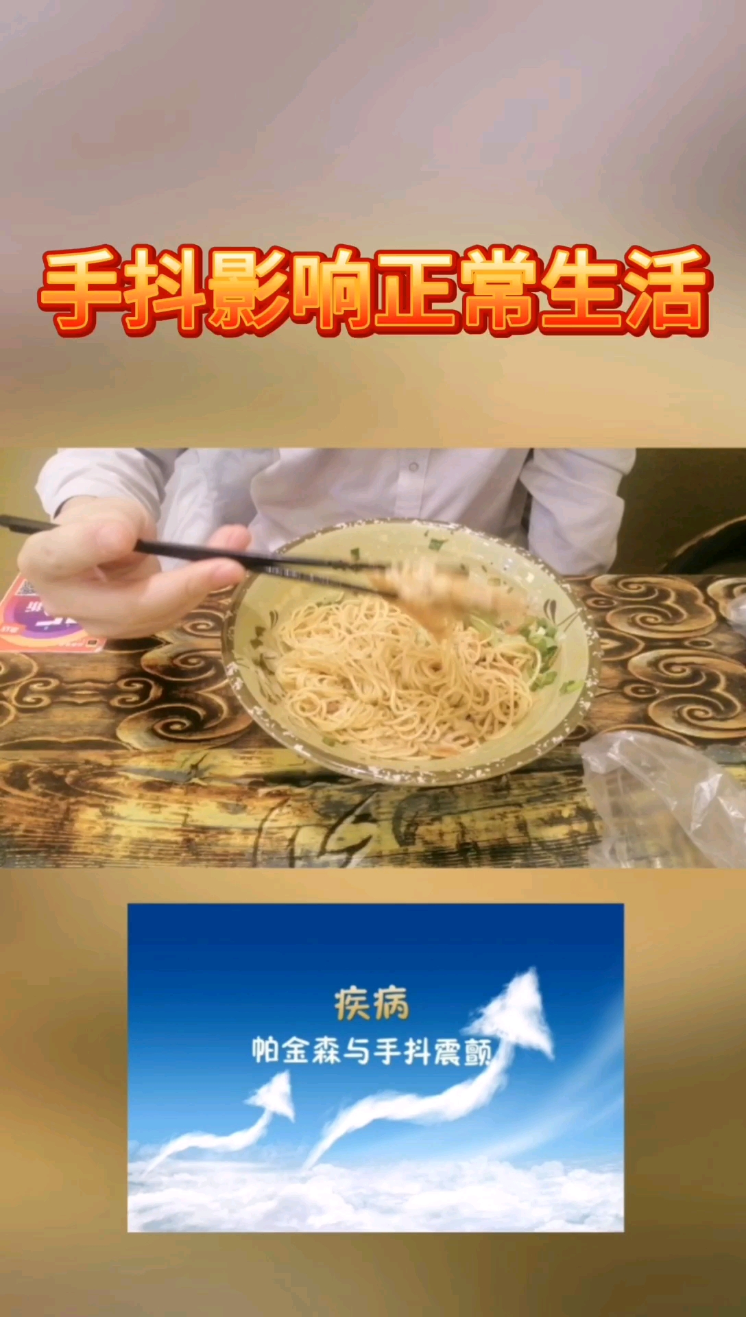 吃饭手抖紧张手抖你有手抖的情况吗