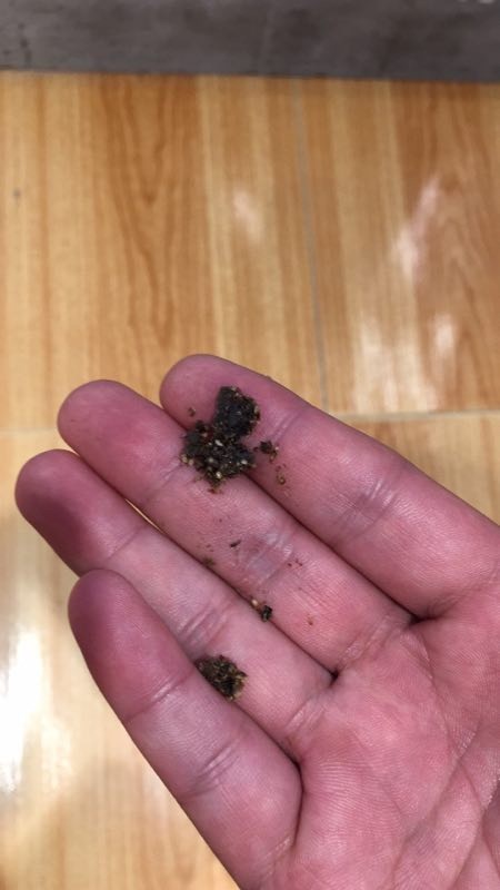 下班回家路上被鸟屎砸中什么水平?