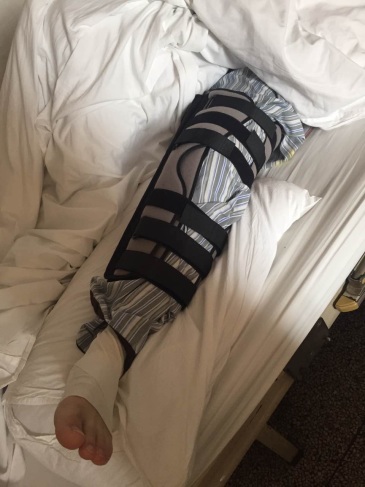 一个膝盖,可能要让我后悔一辈子了…