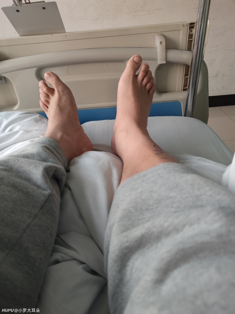 跟腱断裂 虎扑 跟腱断裂 虎扑