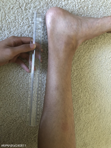 虽然不知道跟腱准确的范围 但应该不算短