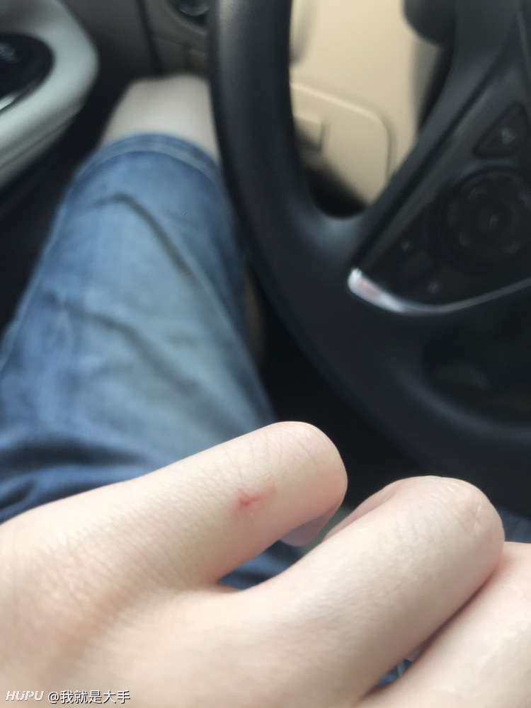 打狂犬疫苗强迫捆绑打2400的血清正常吗?不打这个血清就不给你打疫苗