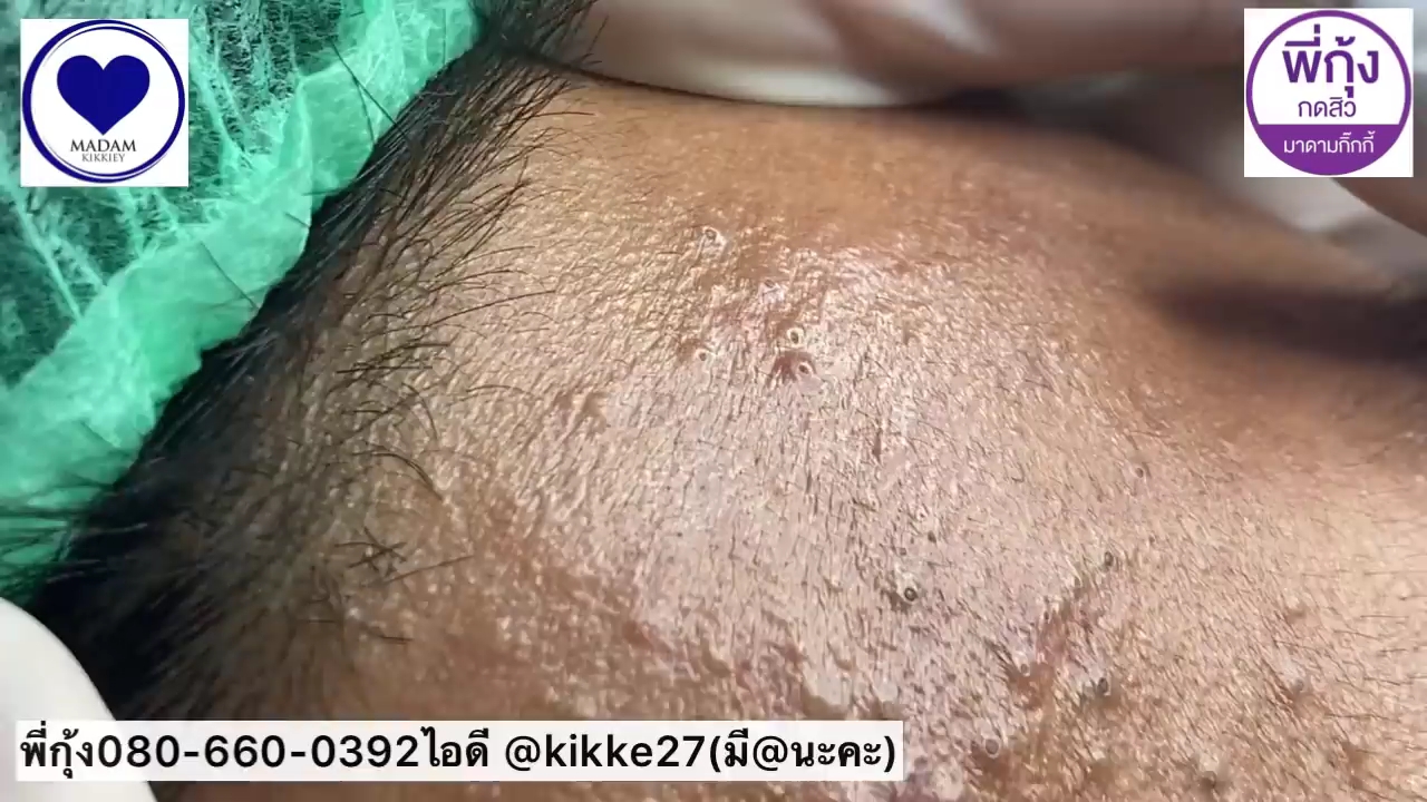 video-poster