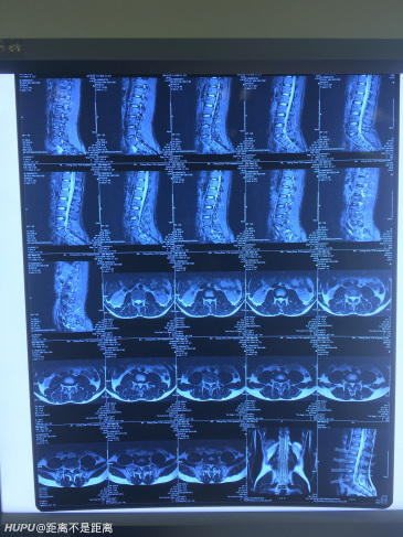 在下是一名脊柱骨科医生,大家有什么想问的?