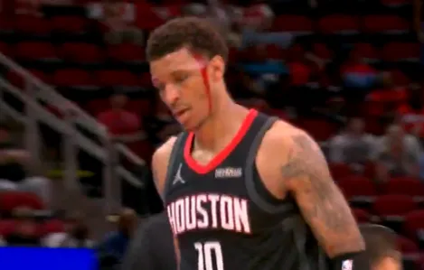 記者：皇馬對卡瓦哈爾傷病持謹慎態(tài)度，與球員想踢世界杯愿望沖突